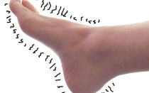 Алкогольная полинейропатия