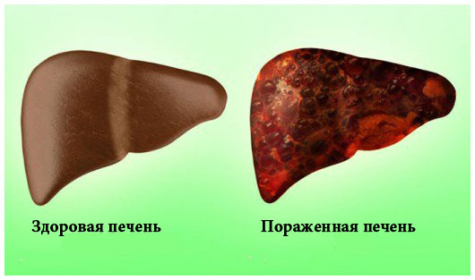 pechen_zdorovay_porazgenay