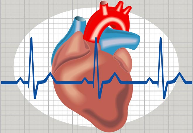 alcagolnay_kardimiopatiy